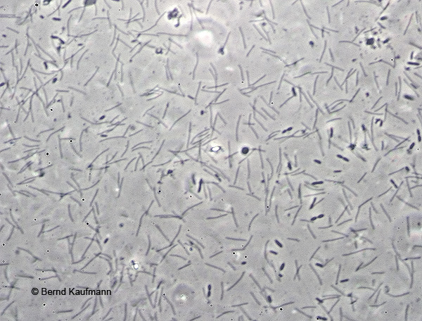 Так бактерии Flexibacter columnaris выглядят под микроскопом.